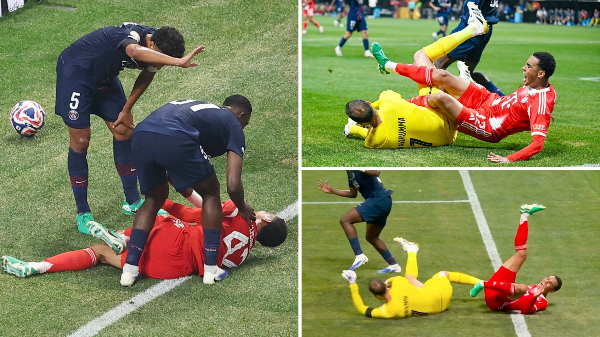 包含瓦伦西亚传奇：球星大腿受伤的词条